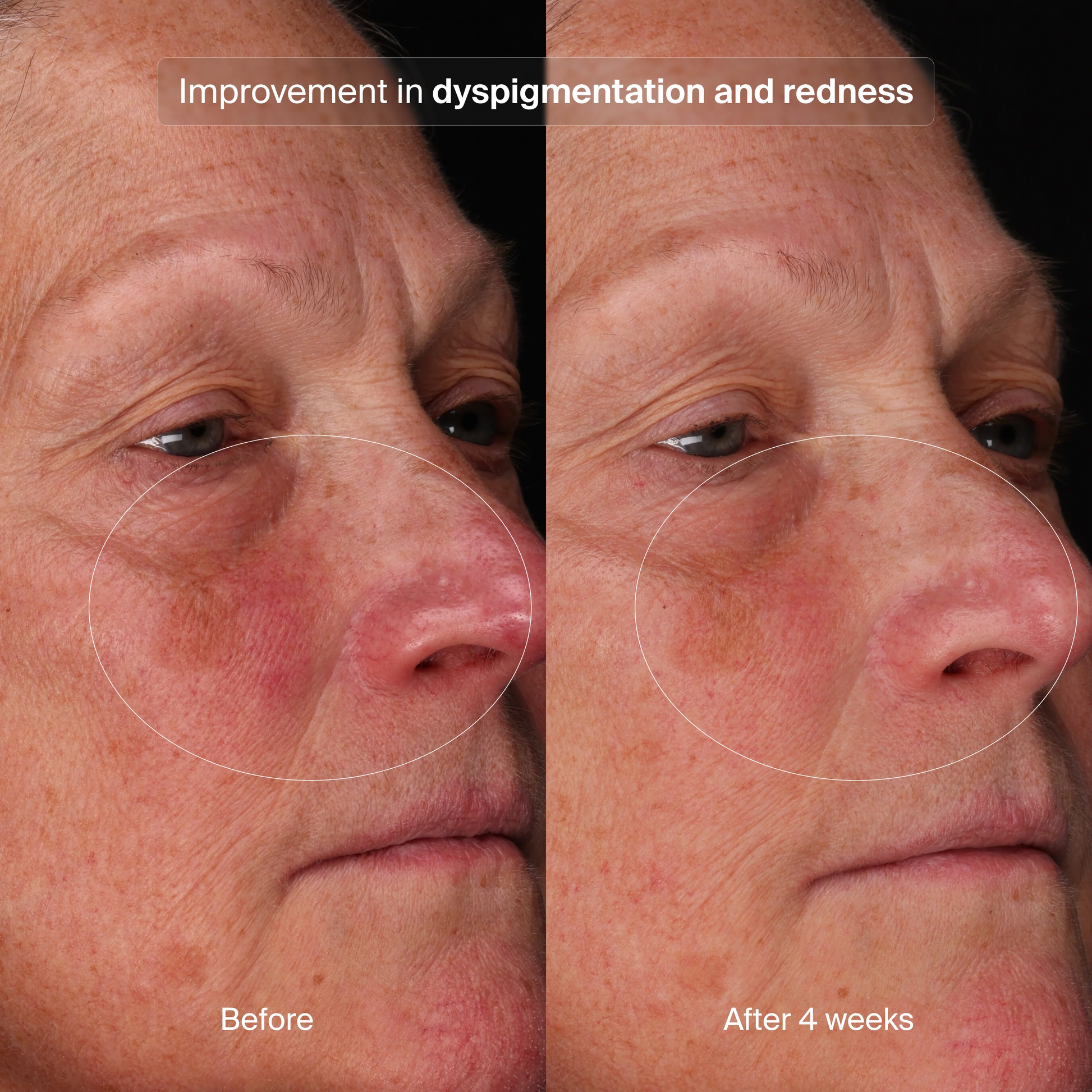 Pavise Bioadaptive Stress Repair Refill - Freeze Co Beauty