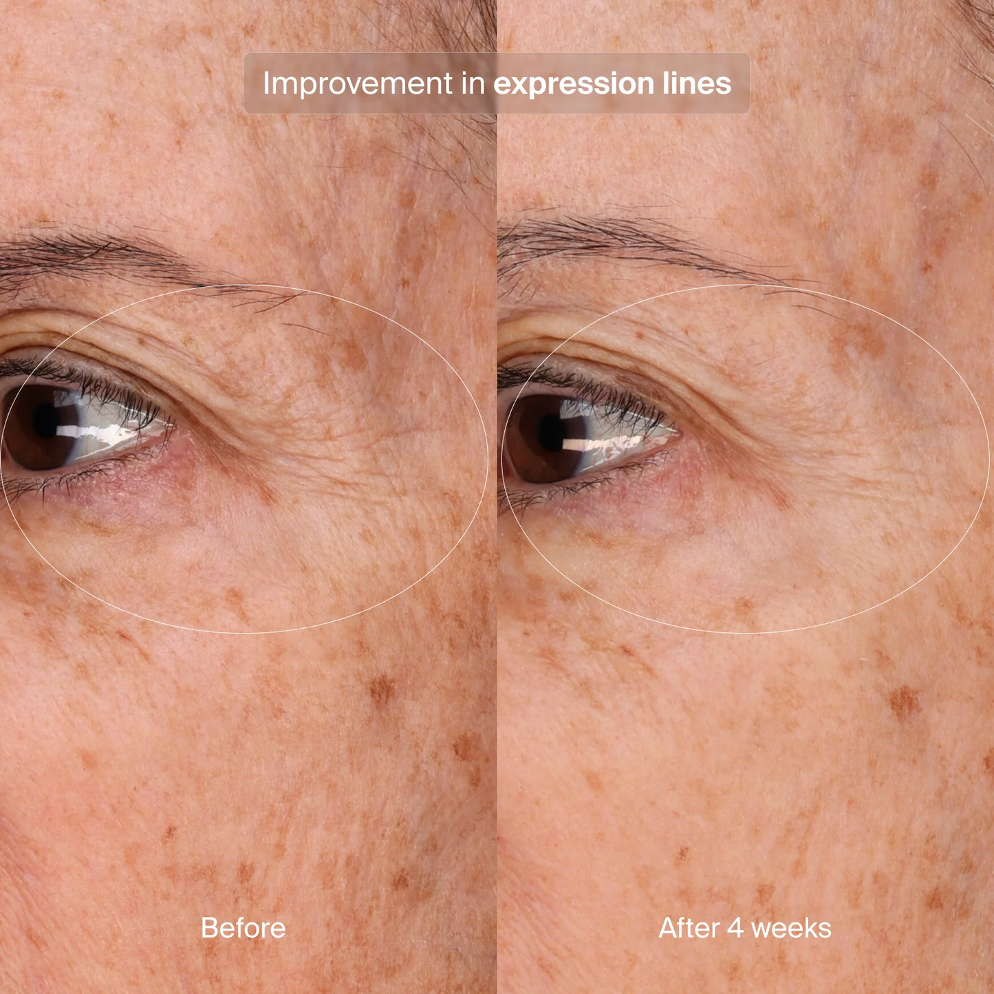 Pavise Precision Eye Lift