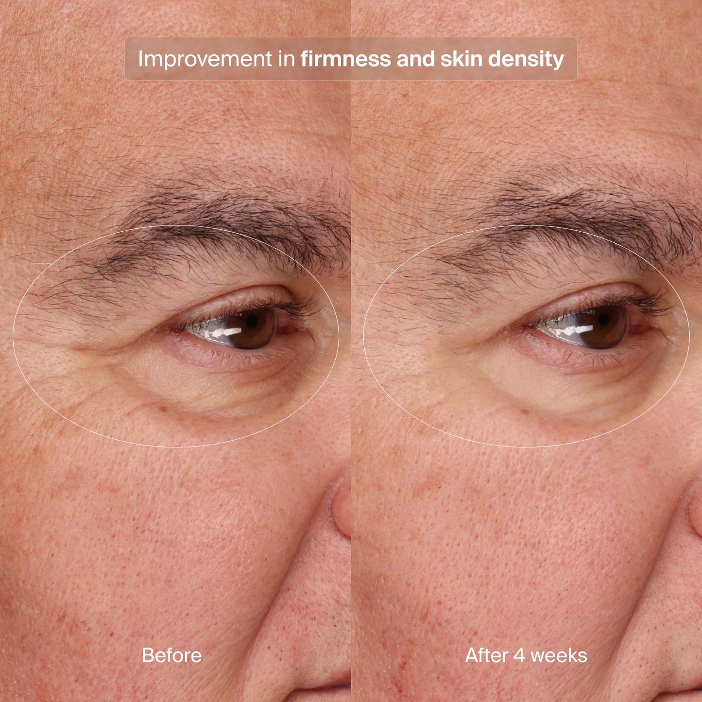 Pavise Precision Eye Lift