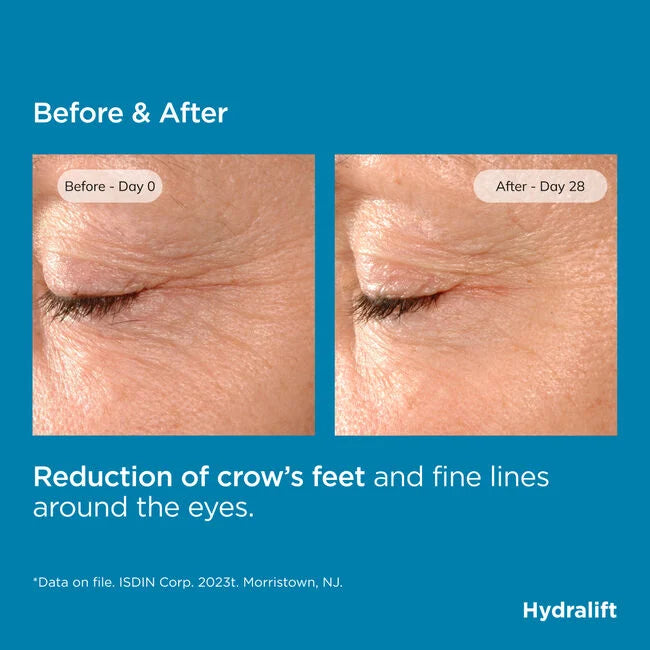 ISDIN Hydralift Serum