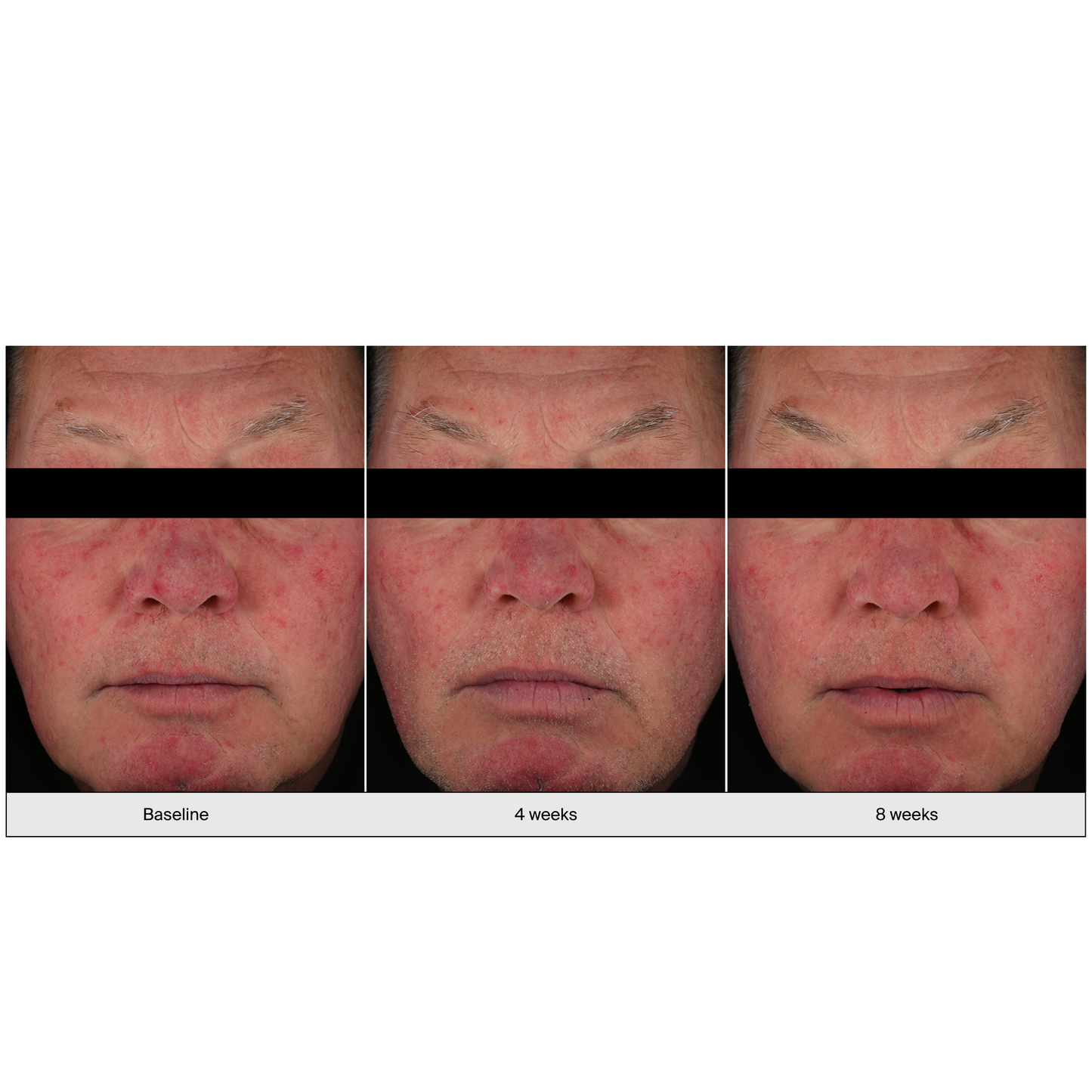 pavise Dynamic Age Defense - Freeze Co Beauty